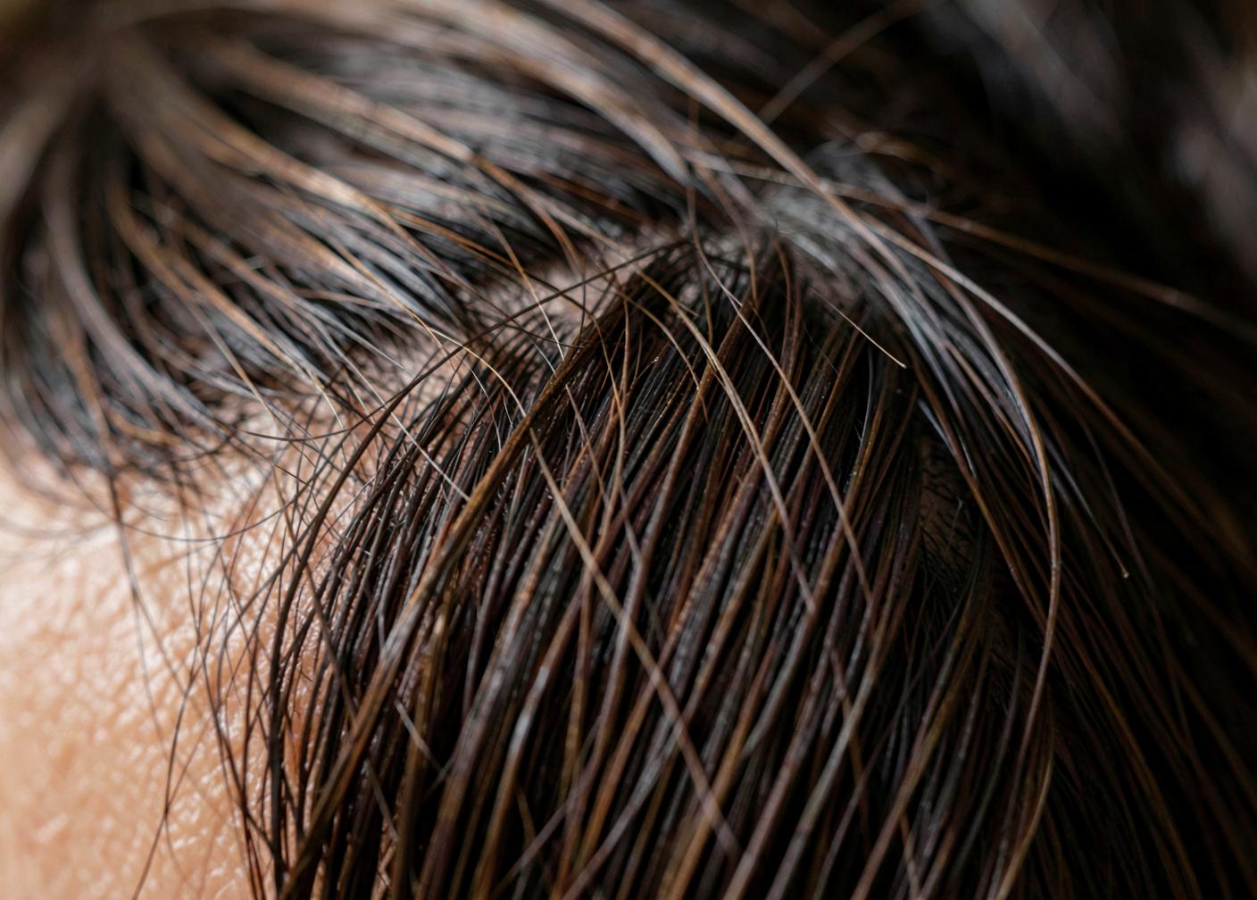 Close-up study of hair and scalp in soft natural light